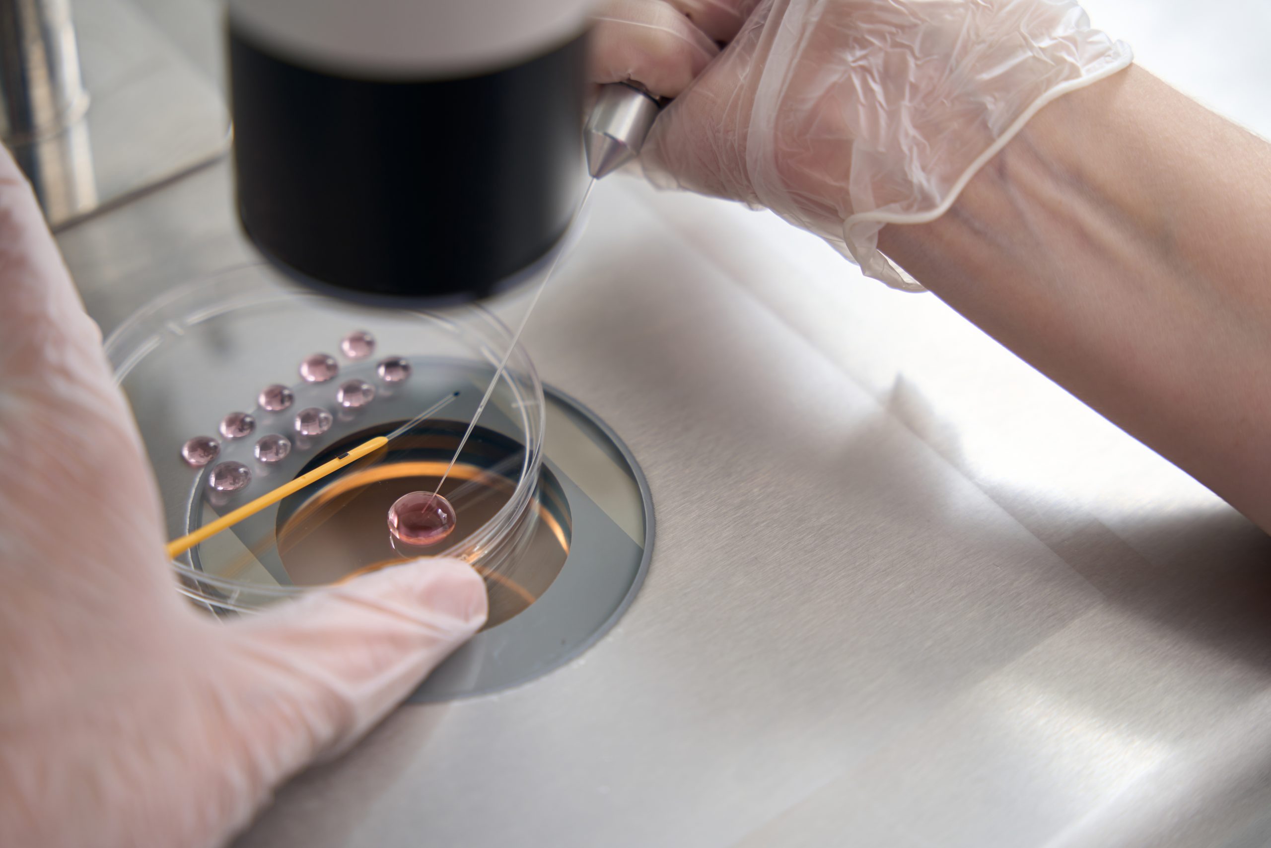how ivf is done