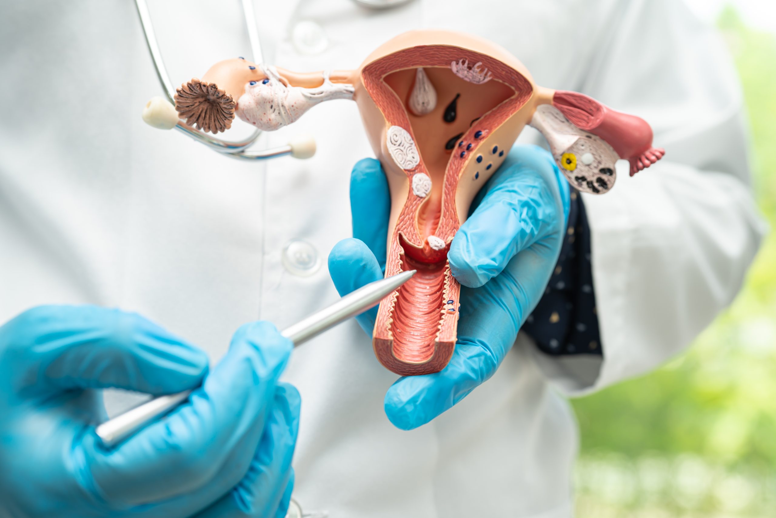 ivf types