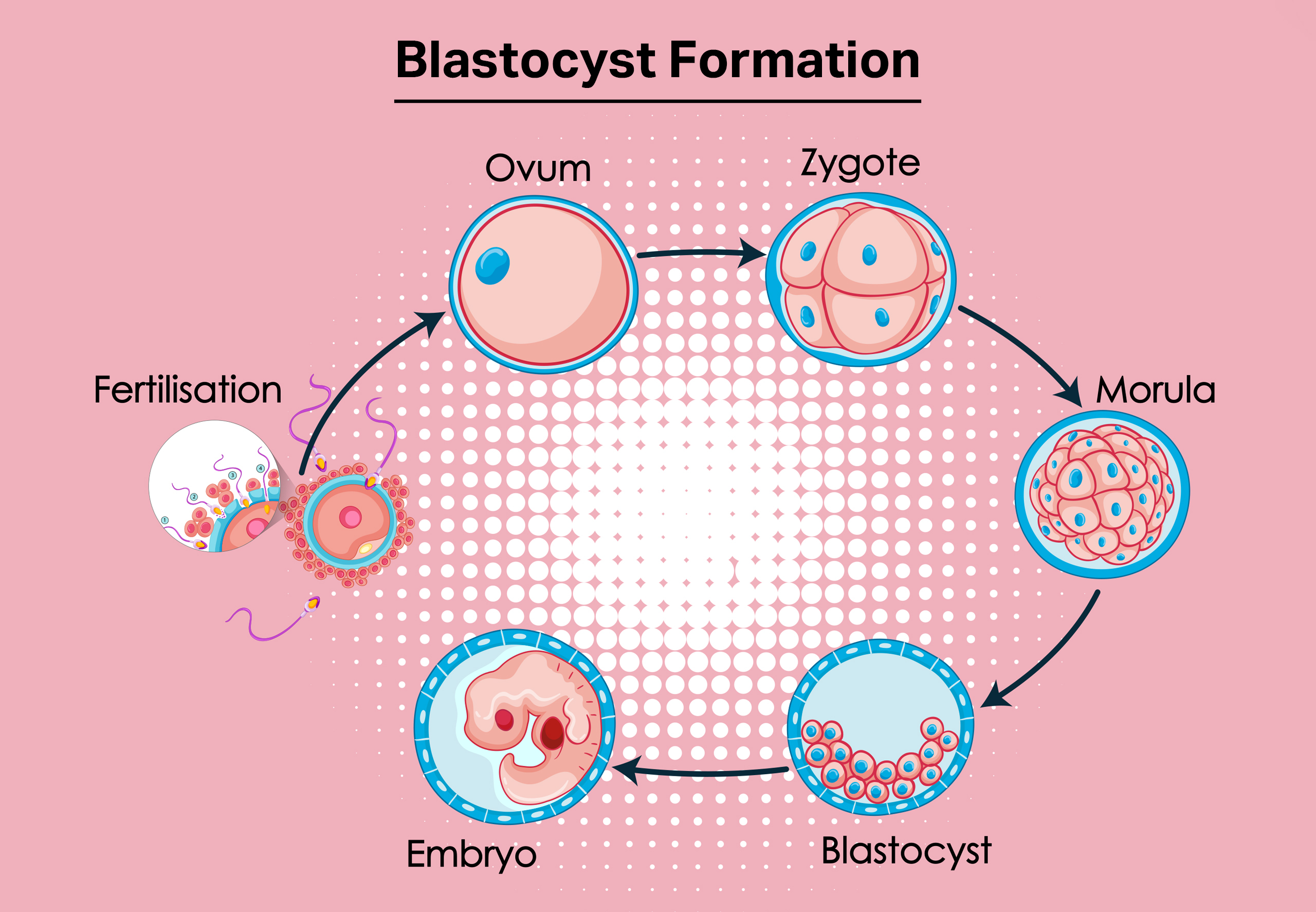 how blastocyst is formed