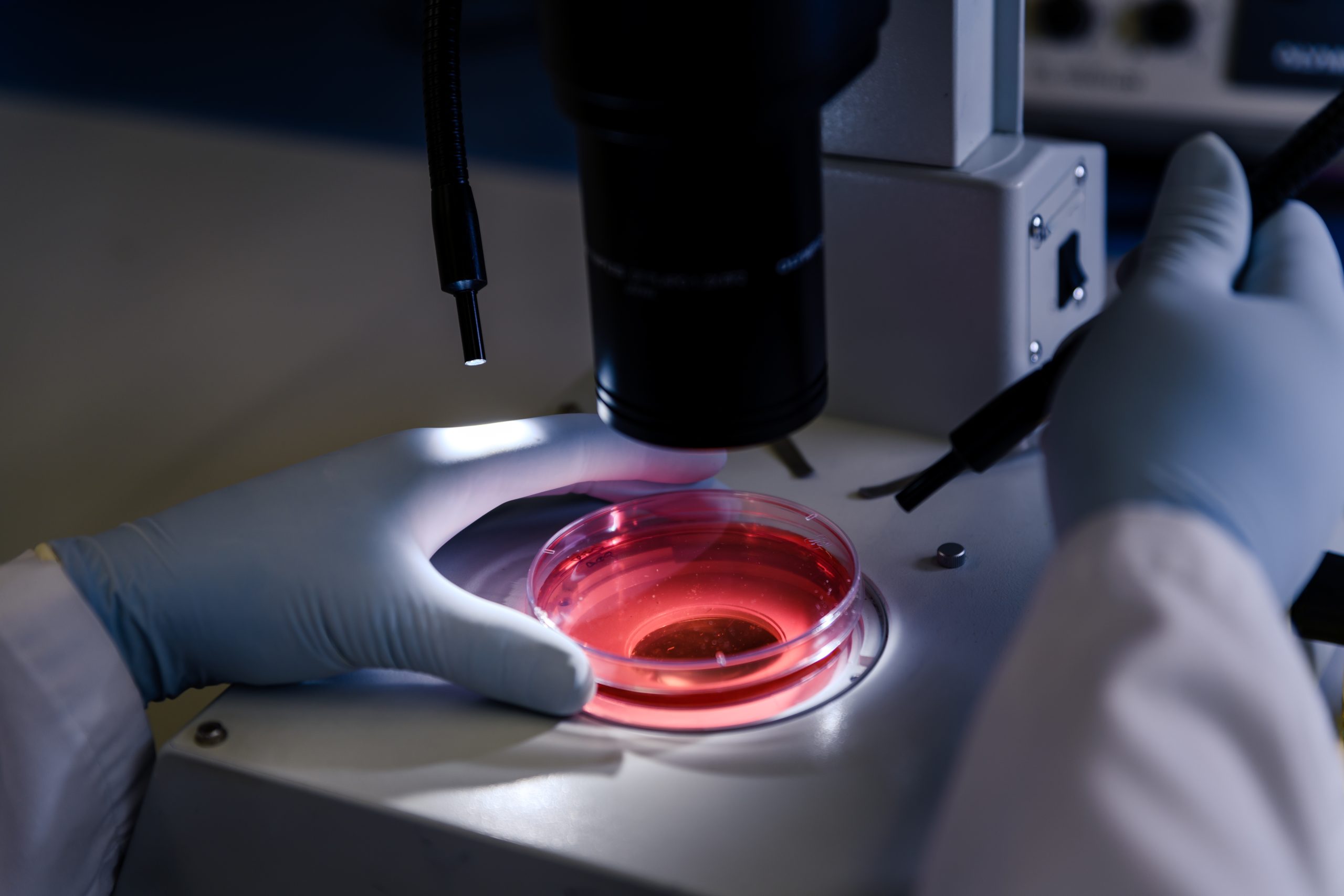 blastocyst transfer in ivf